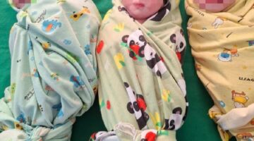 Tiga Bayi Kembar Perempuan Lahir Selamat di RSUD Cut Meutia, Ibu Alami Hipertensi Saat Kehamilan